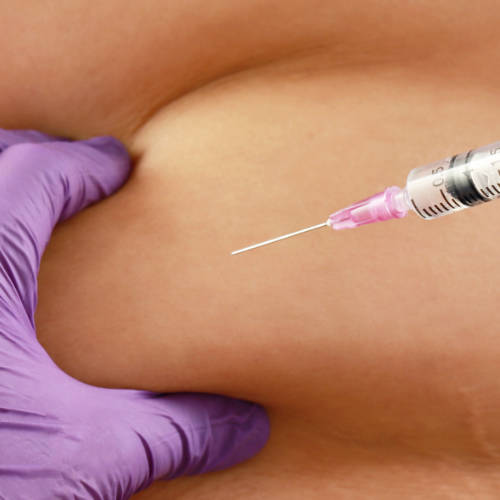 Fat Dissolving Injections Canterbury